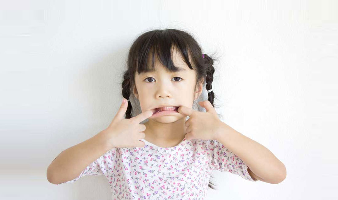 6 Bahan Alami Atasi Sariawan pada Anak 