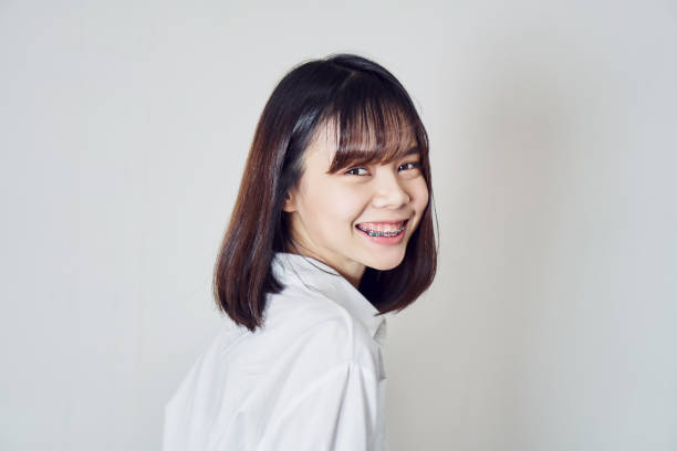 Berkenalan dengan Jenis Kawat Gigi Sebelum Kamu Memasang Behel 