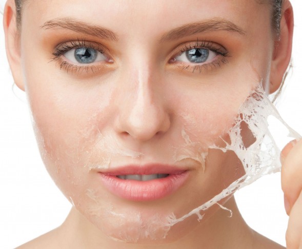 3 Tips Jitu Mengatasi Peeling di Wajah