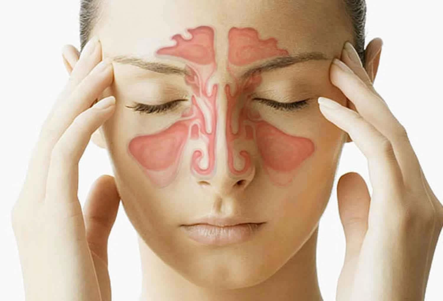 Sering Dianggap Fakta, Ini 5 Mitos Tentang Sinusitis