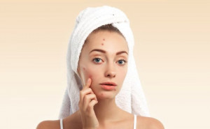 Ampuh, Begini 6 Cara Menghilangkan Jerawat Bruntusan di Wajah Secara Alami