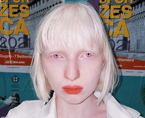 Kenalan Dengan Sosok Model Nastya Zhidkova Albino Yang Inspiratif