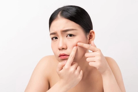 Jangan Rakus! Ini 8 Cara Detox Wajah Berjerawat