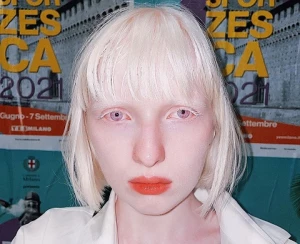 Kenalan dengan Sosok Model Nastya Zhidkova Albino yang Inspiratif