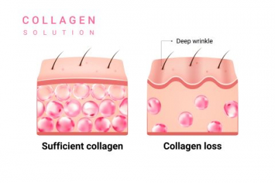 Konsumsi 7 Makanan Yang Mengandung Kolagen Tinggi, Badan Sehat dan Kuat